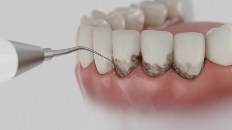 Trusted Teeth Cleaning And Checkup service in Columbia, MO - Dentist Open Now
